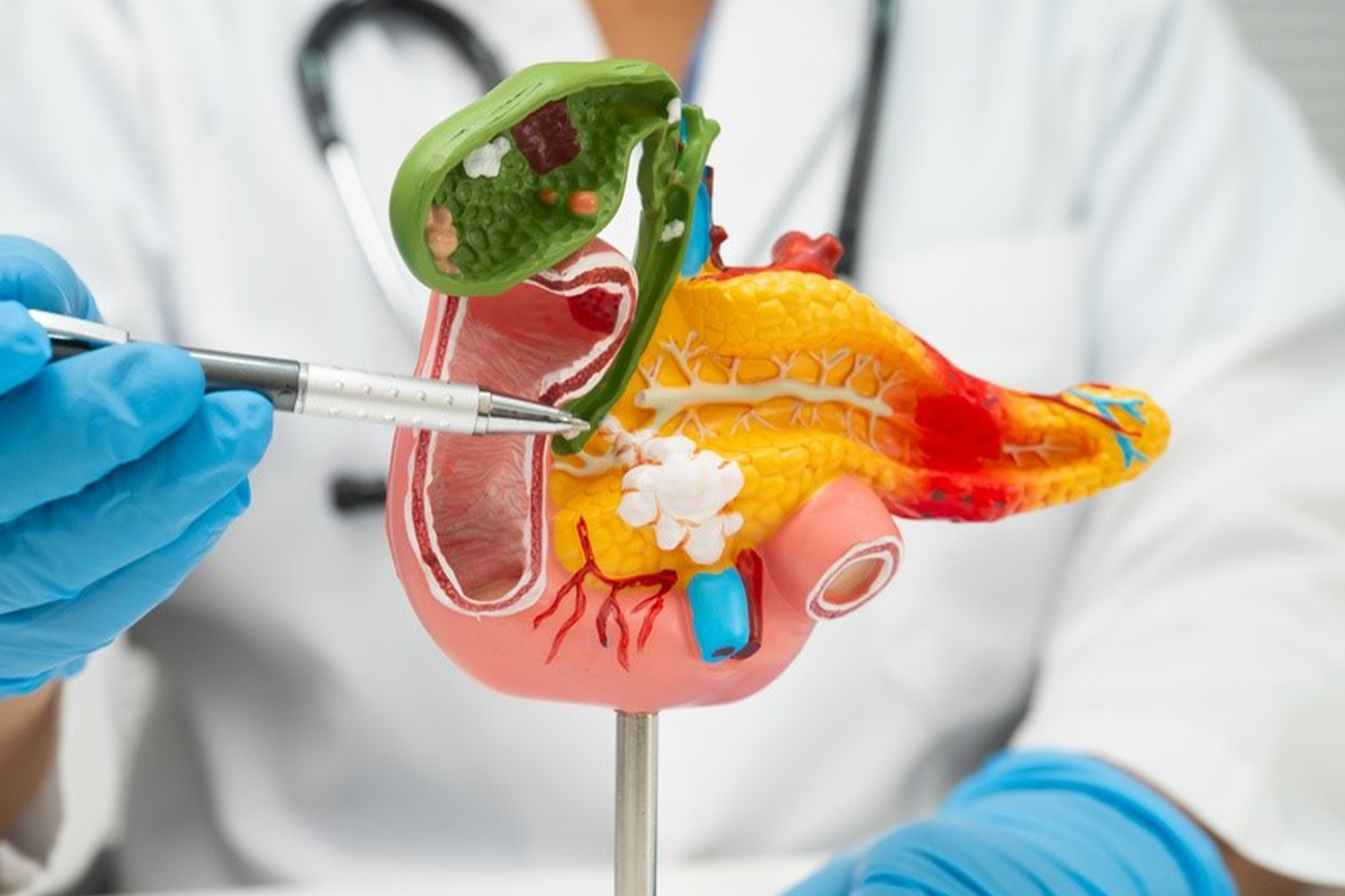 Acute & Chronic Pancreatitis