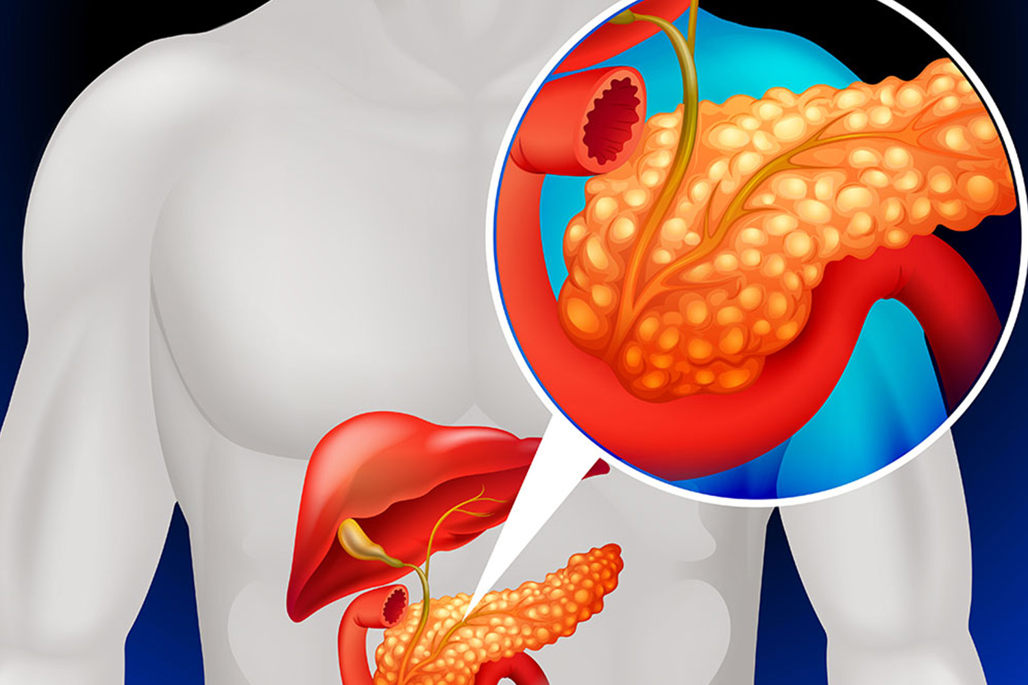 GI, Liver & Pancreatic Cancers
