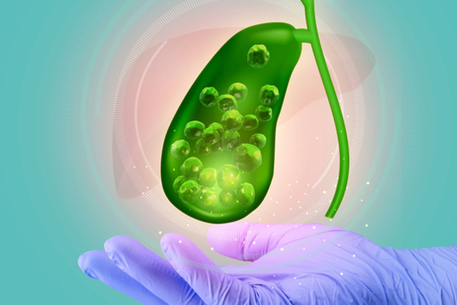 Gallbladder & CBD Stones